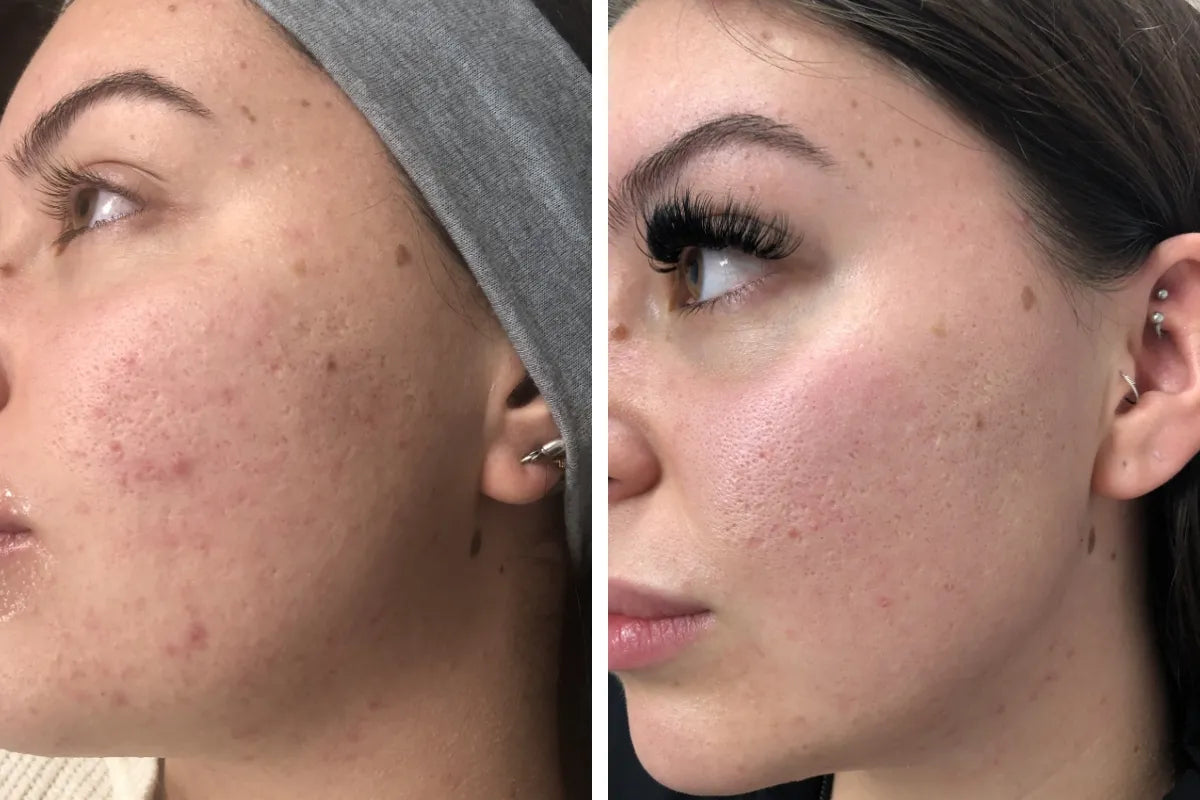 Complete Skin Care Bundle
