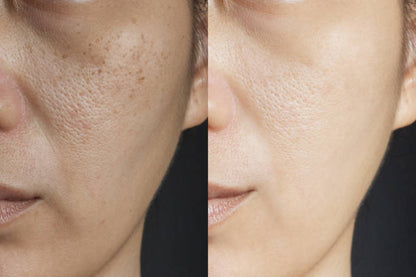 Complete Skin Care Bundle